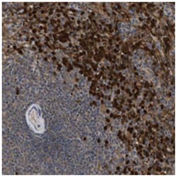 SULT1B1, Rabbit, Polyclonal Antibody, Abnova 100&mu;L; Unlabeled:Antibodies,