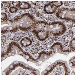 KDM6A, Rabbit, Polyclonal Antibody, Abnova 100&mu;L; Unlabeled:Antibodies,