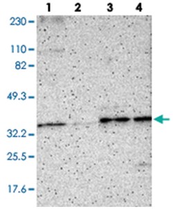 PSMD14, Rabbit, Polyclonal Antibody, Abnova 100&mu;L; Unlabeled:Antibodies,