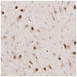 PSMD14, Rabbit, Polyclonal Antibody, Abnova 100&mu;L; Unlabeled:Antibodies,