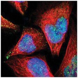 PSMD14, Rabbit, Polyclonal Antibody, Abnova 100&mu;L; Unlabeled:Antibodies,