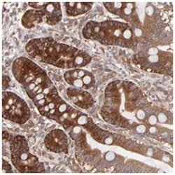 GART, Rabbit, Polyclonal Antibody, Abnova 100&mu;L; Unlabeled:Antibodies,