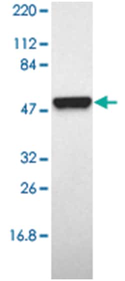 ALDH1A1 Rabbit anti-Human, Polyclonal Antibody, Abnova 100&mu;L; Unlabeled:Antibodies,