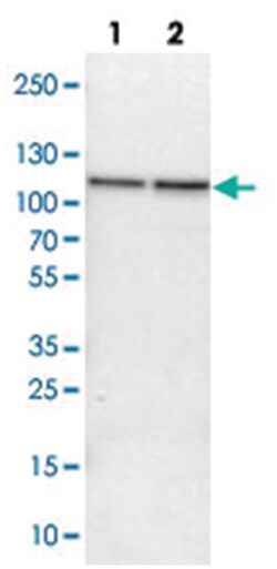 FAM62B, Rabbit, Polyclonal Antibody, Abnova 100 &mu;L | Buy Online | Abnova Corporation | Fisher Scientific