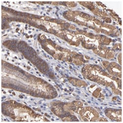 FAM62B, Rabbit, Polyclonal Antibody, Abnova 100 &mu;L | Buy Online | Abnova Corporation | Fisher Scientific