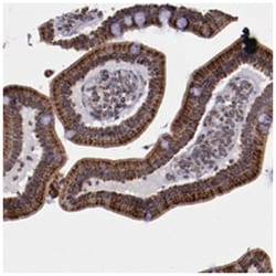 LONP1, Rabbit, Polyclonal Antibody, Abnova 100&mu;L; Unlabeled:Antibodies,