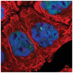 ALDOB, Rabbit, Polyclonal Antibody, Abnova 100&mu;L; Unlabeled:Antibodies,