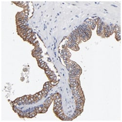 LNX1, Rabbit, Polyclonal Antibody, Abnova 100 &mu;L | Buy Online | Abnova Corporation | Fisher Scientific
