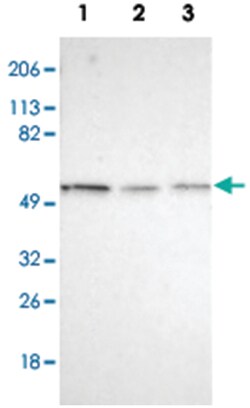IRF8 Rabbit anti-Human, Polyclonal Antibody, Abnova 100 &mu;L | Buy Online | Abnova Corporation | Fisher Scientific