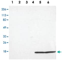 TTR Rabbit anti-Human, Polyclonal Antibody, Abnova 100 &mu;L | Buy Online | Abnova Corporation | Fisher Scientific