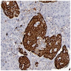TTR Rabbit anti-Human, Polyclonal Antibody, Abnova 100 &mu;L | Buy Online | Abnova Corporation | Fisher Scientific