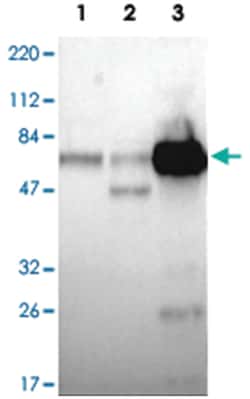 SERPINA3 Rabbit anti-Human, Polyclonal Antibody, Abnova 100&mu;L; Unlabeled:Antibodies,