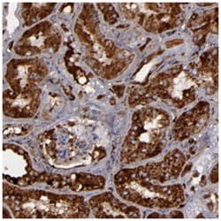 SERPINA3 Rabbit anti-Human, Polyclonal Antibody, Abnova 100&mu;L; Unlabeled:Antibodies,