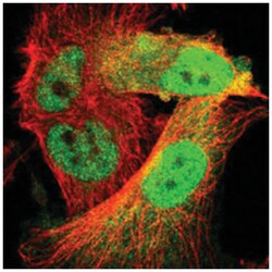 CDK6 Rabbit anti-Human, Polyclonal Antibody, Abnova 100&mu;L; Unlabeled:Antikroppar