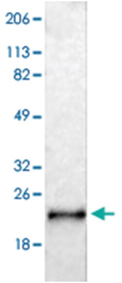 LCN2 Rabbit anti-Human, Polyclonal Antibody, Abnova 100 &mu;L | Buy Online | Abnova Corporation | Fisher Scientific