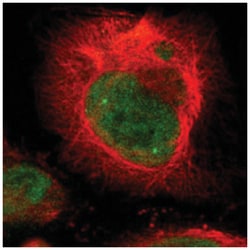 DSN1 Rabbit anti-Human, Polyclonal Antibody, Abnova 100 &mu;L | Buy Online | Abnova Corporation | Fisher Scientific