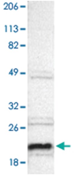 ALG13, Rabbit, Polyclonal Antibody, Abnova 100 &mu;L | Buy Online | Abnova Corporation | Fisher Scientific