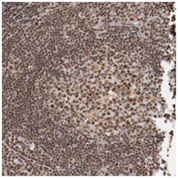 STAG2, Rabbit, Polyclonal Antibody, Abnova 100 &mu;L | Buy Online | Abnova Corporation | Fisher Scientific