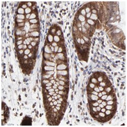FRMD8, Rabbit, Polyclonal Antibody, Abnova 100 &mu;L | Buy Online | Abnova Corporation | Fisher Scientific