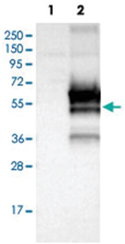 FRMD8, Rabbit, Polyclonal Antibody, Abnova 100 &mu;L | Buy Online | Abnova Corporation | Fisher Scientific