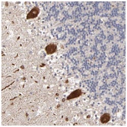 STS, Rabbit, Polyclonal Antibody, Abnova 100 &mu;L | Buy Online | Abnova Corporation | Fisher Scientific