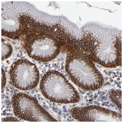 EXDL2, Rabbit, Polyclonal Antibody, Abnova 100 &mu;L | Buy Online | Abnova Corporation | Fisher Scientific