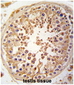 SPAG9 Rabbit anti-Human, Polyclonal Antibody, Abnova 400 &mu;L | Buy Online | Abnova Corporation | Fisher Scientific