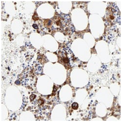 FLNA, Rabbit, Polyclonal Antibody, Abnova 100&mu;L; Unlabeled:Antibodies,