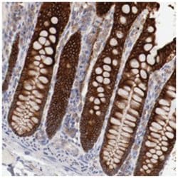ENTPD5, Rabbit, Polyclonal Antibody, Abnova 100 &mu;L | Buy Online | Abnova Corporation | Fisher Scientific