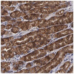 TIMM9, Rabbit, Polyclonal Antibody, Abnova 100 &mu;L | Buy Online | Abnova Corporation | Fisher Scientific