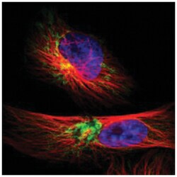 TIMM9, Rabbit, Polyclonal Antibody, Abnova 100 &mu;L | Buy Online | Abnova Corporation | Fisher Scientific