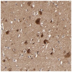 BDKRB1 Rabbit anti-Human, Polyclonal Antibody, Abnova 100 &mu;L | Buy Online | Abnova Corporation | Fisher Scientific