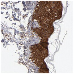 AHNAK2, Rabbit, Polyclonal Antibody, Abnova 100 &mu;L | Buy Online | Abnova Corporation | Fisher Scientific