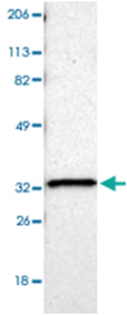 HCCS, Rabbit, Polyclonal Antibody, Abnova 100 &mu;L | Buy Online | Abnova Corporation | Fisher Scientific