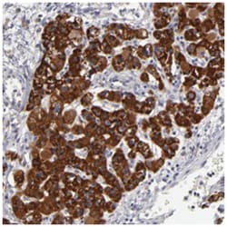 HCCS, Rabbit, Polyclonal Antibody, Abnova 100 &mu;L | Buy Online | Abnova Corporation | Fisher Scientific