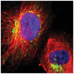 HCCS, Rabbit, Polyclonal Antibody, Abnova 100 &mu;L | Buy Online | Abnova Corporation | Fisher Scientific