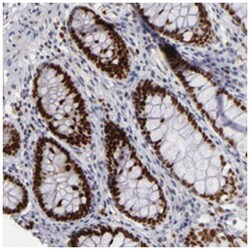 POLA1, Rabbit, Polyclonal Antibody, Abnova 100&mu;L; Unlabeled:Antibodies,