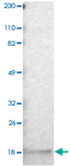 GMFB, Rabbit, Polyclonal Antibody, Abnova 100&mu;L; Unlabeled:Antibodies,