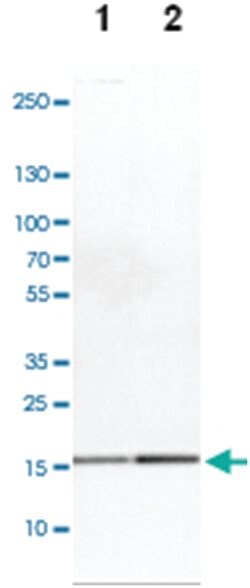 GMFB, Rabbit, Polyclonal Antibody, Abnova 100&mu;L; Unlabeled:Antibodies,