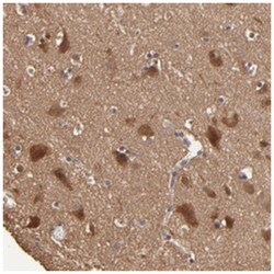 GMFB, Rabbit, Polyclonal Antibody, Abnova 100&mu;L; Unlabeled:Antibodies,