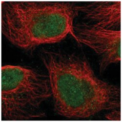 SKAP1, Rabbit, Polyclonal Antibody, Abnova 100&mu;L; Unlabeled:Antibodies,