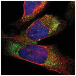 CTSS Rabbit anti-Human, Polyclonal Antibody, Abnova 100 &mu;L | Buy Online | Abnova Corporation | Fisher Scientific