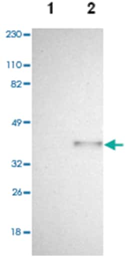 SPARC Rabbit anti-Human, Polyclonal Antibody, Abnova 100 &mu;L | Buy Online | Abnova Corporation | Fisher Scientific