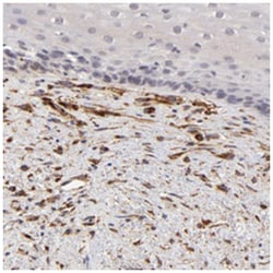 SPARC Rabbit anti-Human, Polyclonal Antibody, Abnova 100 &mu;L | Buy Online | Abnova Corporation | Fisher Scientific