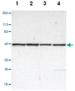 DLST, Rabbit, Polyclonal Antibody, Abnova 100 &mu;L | Buy Online | Abnova Corporation | Fisher Scientific