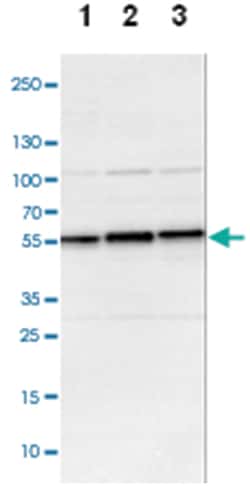 DLST, Rabbit, Polyclonal Antibody, Abnova 100 &mu;L | Buy Online | Abnova Corporation | Fisher Scientific