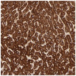 DLST, Rabbit, Polyclonal Antibody, Abnova 100 &mu;L | Buy Online | Abnova Corporation | Fisher Scientific