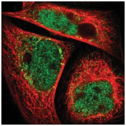 ASB9 Rabbit anti-Human, Polyclonal Antibody, Abnova 100 &mu;L | Buy Online | Abnova Corporation | Fisher Scientific