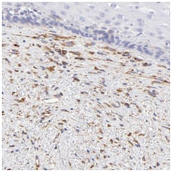 SPARC Rabbit anti-Human, Polyclonal Antibody, Abnova 100&mu;L; Unlabeled:Antibodies,