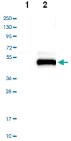 SPARC Rabbit anti-Human, Polyclonal Antibody, Abnova 100&mu;L; Unlabeled:Antibodies,